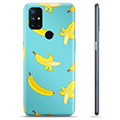 OnePlus Nord N10 5G TPU-Skal - Bananer